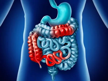 Gastrointestinal Sistem Kanserlerinin Tedavisi